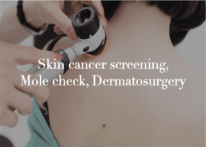 Skin cancer screening, Mole Check, Dermatosurgery