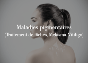 Maladies pigmentaires (traitement de tâches, melasma, vitiligo)