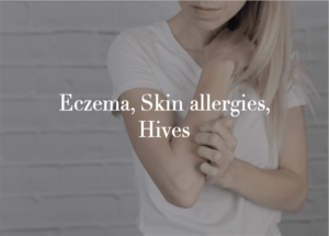 Eczema, skin allergies, hives